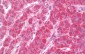 CCL4 / SYCA4 Antibody (Internal)